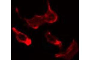 ABIN6274690 staining HuvEc cells by IF/ICC. (Laminin gamma 1 Antikörper  (N-Term))