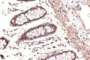 Immunohistochemistry (IHC) image for anti-DEAD (Asp-Glu-Ala-Asp) Box Polypeptide 17 (DDX17) antibody (ABIN7266688)