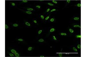 Immunofluorescence of monoclonal antibody to DLX1 on HeLa cell. (DLX1 Antikörper  (AA 152-255))