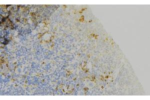 ABIN6273762 at 1/100 staining Human lymph node tissue by IHC-P.