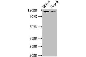 Western Blot Positive WB detected in: MCF-7 whole cell lysate, HepG2 whole cell lysate All lanes: ATP9A antibody at 3. (ATP9A Antikörper  (AA 2-69))