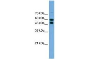 Image no. 1 for anti-Phosphoglucomutase 1 (PGM1) (AA 467-516) antibody (ABIN6746448)