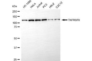 Western blotting analysis using TNFRSF8 antibody (ABIN7800678).