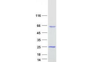 Validation with Western Blot