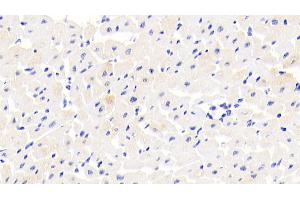 Detection of COL14 in Human Cardiac Muscle Tissue using Polyclonal Antibody to Collagen Type XIV (COL14) (COL14A1 Antikörper  (AA 1280-1461))