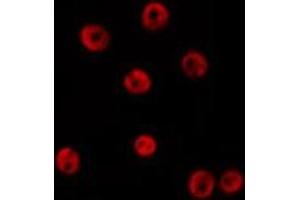 ABIN6276316 staining Hela by IF/ICC. (HDAC4 Antikörper  (Internal Region))
