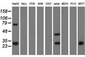 Western blot analysis of extracts (35 µg) from 9 different cell lines by using anti-QPRT monoclonal antibody.
