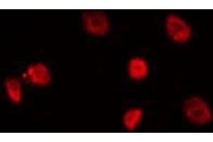 ABIN6275128 staining Hela by IF/ICC. (FOXD4 Antikörper  (Internal Region))