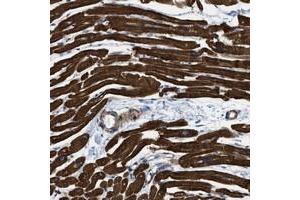 Immunohistochemical staining of human heart muscle with KCNH7 polyclonal antibody  shows strong cytoplasmic positivity in myocytes at 1:1000-1:2500 dilution. (KCNH7 Antikörper)