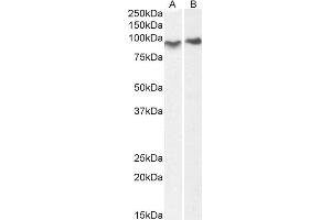 Image no. 1 for anti-ArfGAP with Coiled-Coil, Ankyrin Repeat and PH Domains 2 (ACAP2) antibody (ABIN5893415) (Centaurin beta 2 Antikörper)