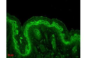 Immunohistochemistry analysis using Rabbit Anti-ERK1 Polyclonal Antibody . (ERK1 Antikörper  (APC))