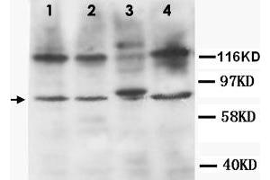Western Blot analysis of TNFRSF1B expression from cell extracts with TNFRSF1B polyclonal antibody . (TNFRSF1B Antikörper  (N-Term))