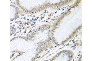 Immunohistochemistry of paraffin-embedded Human stomach using RPN2 Polyclonal Antibody at dilution of 1:100 (40x lens). (Ribophorin II Antikörper)