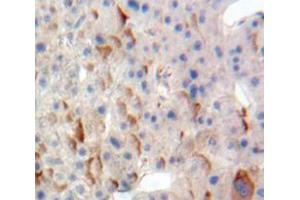Used in DAB staining on fromalin fixed paraffin-embedded Liver tissue (TPBG Antikörper  (AA 32-351))