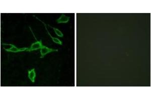 Immunofluorescence analysis of LOVO cells, using HRH1 Antibody. (HRH1 Antikörper  (AA 141-190))