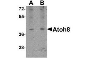 Western blot analysis of ATOH8 in A-20 cell lysate with this product atOH8 antibody at (A) 1 and (B) 2 μg/ml. (ATOH8 Antikörper  (C-Term))