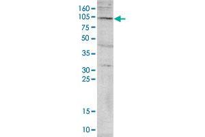 Western blot was performed on nuclear extracts from HeLa cells (HeLa NE, 40 ug) with PADI4 polyclonal antibody , diluted 1 : 1,000 in TBS-Tween containing 5% skimmed milk. (PAD4 Antikörper)