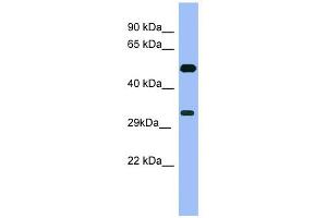 WB Suggested Anti-MAGEB1 Antibody Titration: 0. (MAGEB1 Antikörper  (Middle Region))