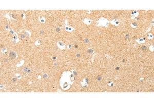 Immunohistochemistry of paraffin-embedded Human brain tissue using TNXB Polyclonal Antibody at dilution 1:40 (TNXB Antikörper)
