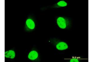Immunofluorescence of monoclonal antibody to SOX18 on HeLa cell.