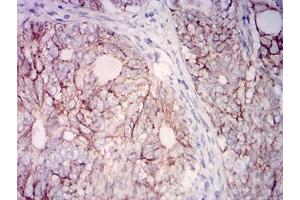 Immunohistochemistry (IHC) image for anti-Prostaglandin F2 Receptor Negative Regulator (PTGFRN) (AA 46-221) antibody (ABIN7193421)