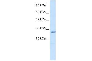 WB Suggested Anti-CLIC2 Antibody Titration:  1. (CLIC2 Antikörper  (Middle Region))