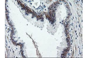 Image no. 1 for anti-Dystrobrevin, beta (DTNB) antibody (ABIN1497913) (Dystrobrevin beta Antikörper)