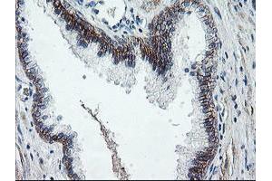 Image no. 1 for anti-Dystrobrevin, beta (DTNB) antibody (ABIN1497913)