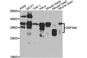 Western blot analysis of extracts of various cell lines, using ZNF346 antibody (ABIN5975303) at 1/1000 dilution. (ZNF346 Antikörper)
