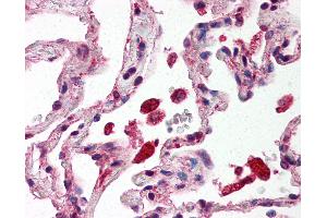 Anti-STAT1 antibody IHC of human lung, alveolar macrophages. (STAT1 Antikörper  (C-Term))