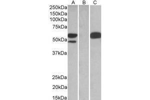 HEK293 lysate (10 µg protein in RIPA buffer) overexpressing Human TRIM21 with C-terminal MYC tag probed with AP22453PU-N TRIM21 antibody (1 µg/ml) in Lane A and probed with anti-MYC Tag (1/1000) in Lane C. (TRIM21 Antikörper  (C-Term))