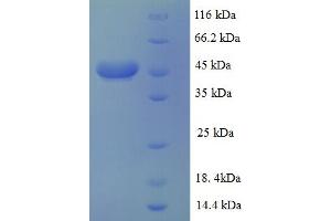 SDS-PAGE (SDS) image for Ribosomal Protein, Large, P0 (RPLP0) (AA 1-317), (full length) protein (His-SUMO Tag) (ABIN5710280)