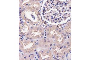 (ABIN6243119 and ABIN6578706) staining COPS7B in human kidney tissue sections by Immunohistochemistry (IHC-P - paraformaldehyde-fixed, paraffin-embedded sections). (COPS7B Antikörper  (AA 61-95))