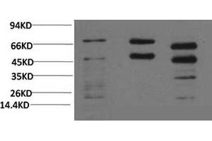 Western Blotting (WB) image for anti-Phosphoserine (Phosphospecific) antibody (ABIN5962159)