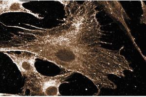 Immunofluorescent staining of human fibroblast cells. (RAC1 Antikörper)