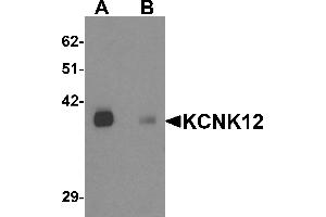 Western blot analysis of KCNK12 in rat brain tissue lysate with KCNK12 antibody at 0. (KCNK12 Antikörper  (C-Term))