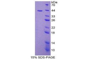 SDS-PAGE (SDS) image for Chemokine (C-C Motif) Ligand 8 (CCL8) (AA 1-99) protein (His tag,GST tag) (ABIN1980645)