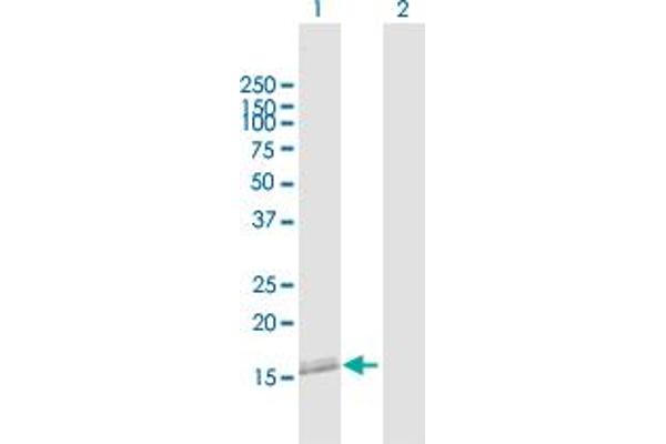 NANOS2 Antikörper  (AA 1-138)