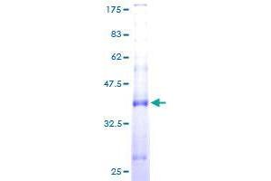 SPCS1 Protein (AA 1-104) (GST tag)