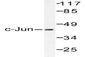 Image no. 2 for anti-Jun Proto-Oncogene (JUN) antibody (ABIN265356) (C-JUN Antikörper)