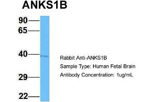 Host: Rabbit Target Name: ANKS1B Sample Type: Human Fetal Brain Antibody Dilution: 1. (ANKS1B Antikörper  (C-Term))