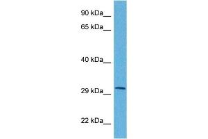 Host:  Rabbit  Target Name:  APOBEC3B  Sample Tissue:  Human HCT116 Whole Cell  Antibody Dilution:  1ug/ml (APOBEC3B Antikörper  (N-Term))