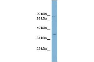 WB Suggested Anti-GPD2 Antibody Titration:  0. (GPD2 Antikörper  (Middle Region))