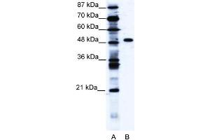 WB Suggested Anti-ZNF541 Antibody Titration: 1. (ZNF541 Antikörper  (Middle Region))