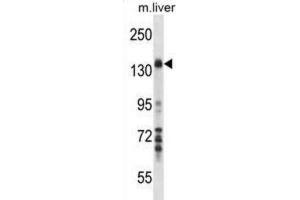 Western Blotting (WB) image for anti-Mitogen-Activated Protein Kinase Kinase Kinase 1 (MAP3K1) antibody (ABIN2998117)