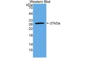 Western blot analysis of the recombinant protein. (Nephrin Antikörper  (AA 27-234))