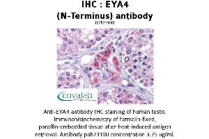 Image no. 2 for anti-Eyes Absent Homolog 4 (EYA4) (N-Term) antibody (ABIN1734196) (EYA4 Antikörper  (N-Term))