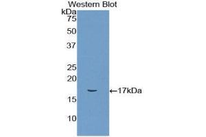 Western Blotting (WB) image for anti-CD72 Molecule (CD72) (AA 126-237) antibody (ABIN1858315) (CD72 Antikörper  (AA 126-237))