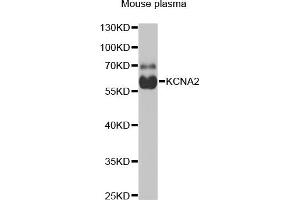 Western blot analysis of extracts of mouse plasma, using KCN antibody (ABIN6129438, ABIN6142695, ABIN6142696 and ABIN6221897) at 1:1000 dilution. (KCNA2 Antikörper  (AA 1-165))