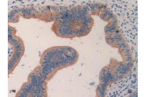 IHC-P analysis of Mouse Uterus Tissue, with DAB staining. (CCL7 Antikörper  (AA 28-97))